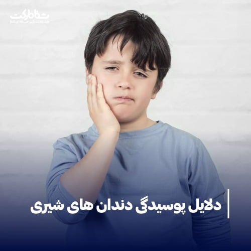 دلایل پوسیدگی دندان های شیری